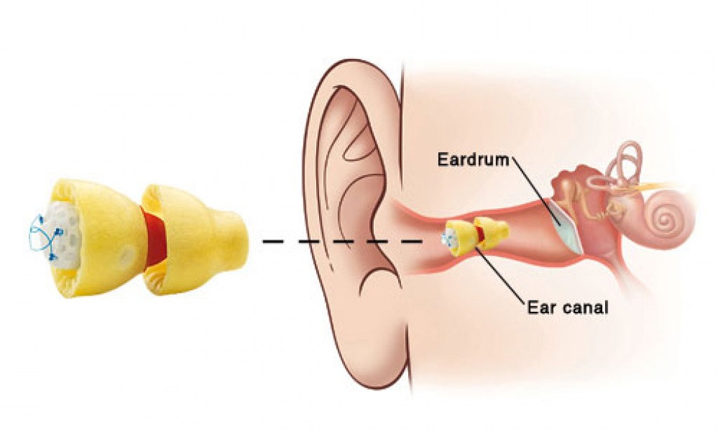6 Top Advantages of Plugging Invisible Hearing Aid For Your Hearing Problem